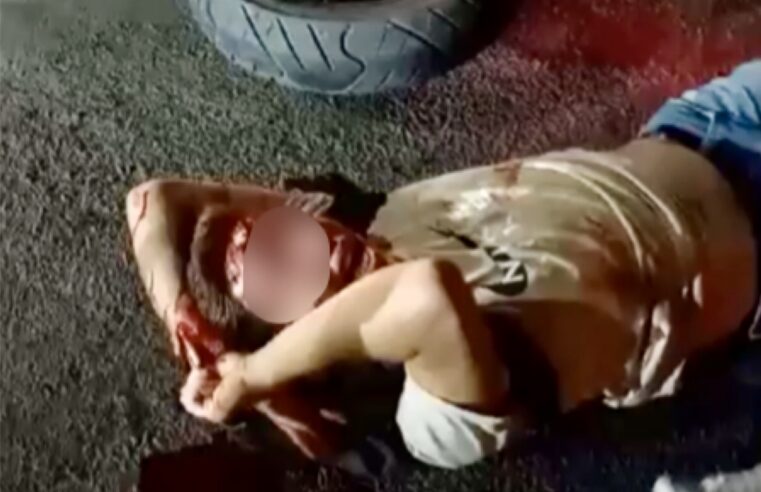 Atropellan a motociclista y su acompañante en la Carretera 175: ambos sufren lesiones graves